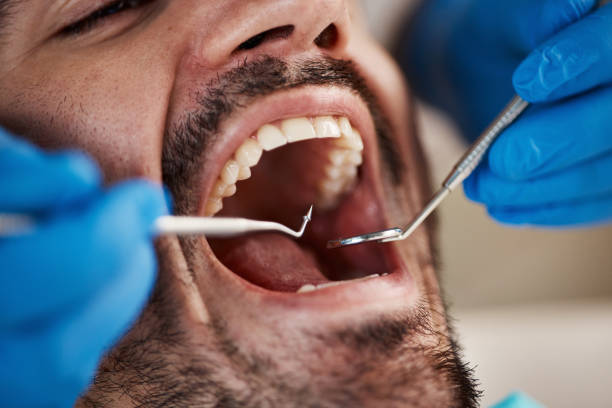 Best Pediatric Emergency Dentist in , MD